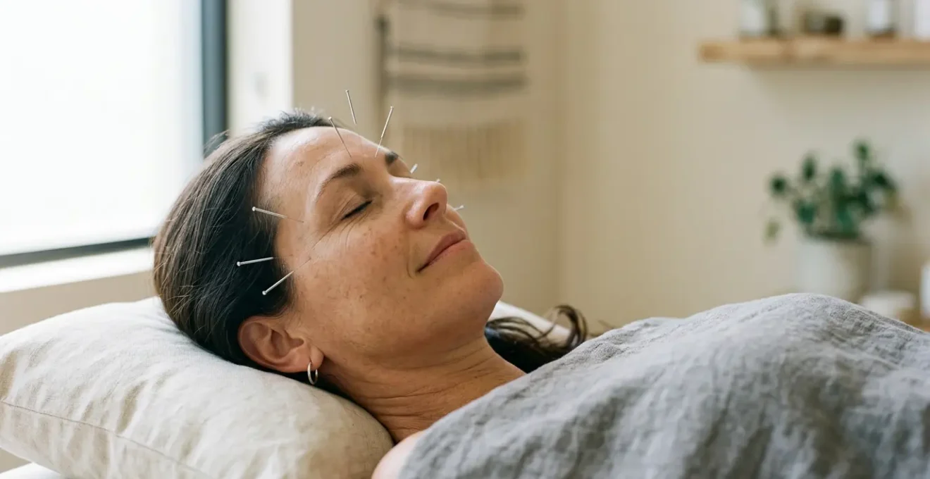 Serene acupuncture treatment setting showing professional healing environment for migraine management