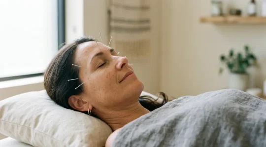 Serene acupuncture treatment setting showing professional healing environment for migraine management