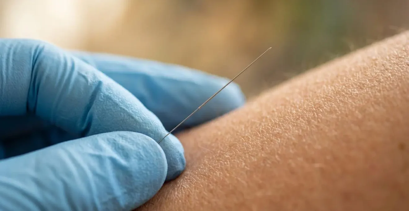 Extreme close-up detail of ultra-fine acupuncture needle demonstrating minimal invasiveness and precision technique
